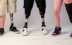 lower limb prosthetics for amputees