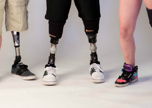 lower limb prosthetics for amputees