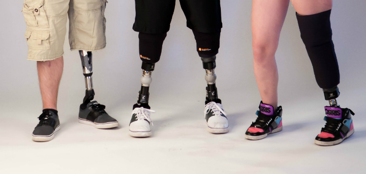 lower limb prosthetics for amputees