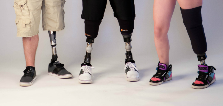 This Is What It's Like To Live With A Prosthetic Leg