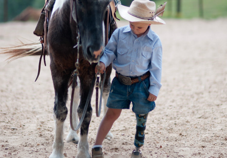 pediatric prosthetics in Arkansas