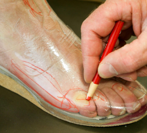 foot orthotics