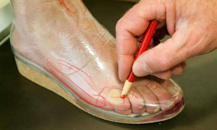 foot orthotics