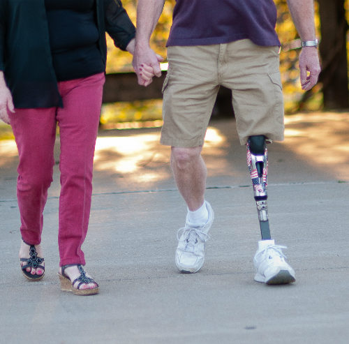 FAQs about prosthetics for amputees