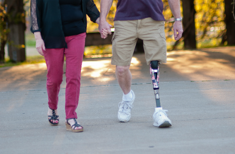 FAQs about prosthetics for amputees