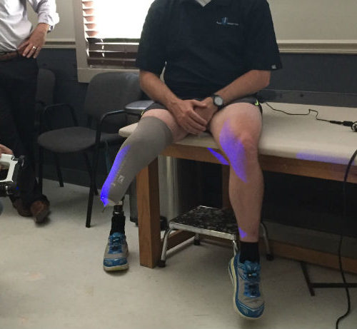 Our new state-of-the-art CAD/CAM scanner allows us to create custom orthotics and prosthetics for you.