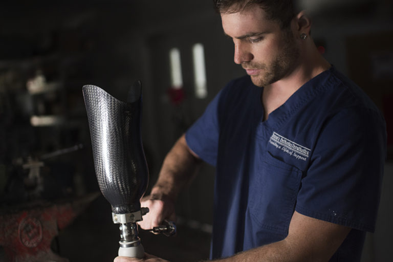 Prosthetics What Are They and How Do They Work?