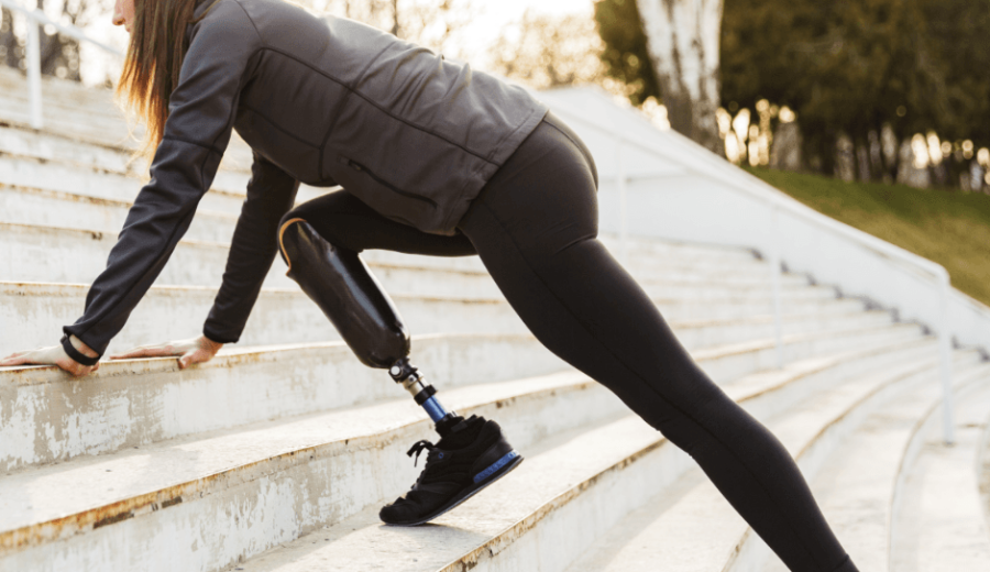 Why You Need a FIT Guide for Your Prosthetic