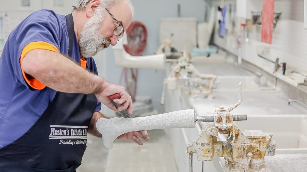 prosthetics