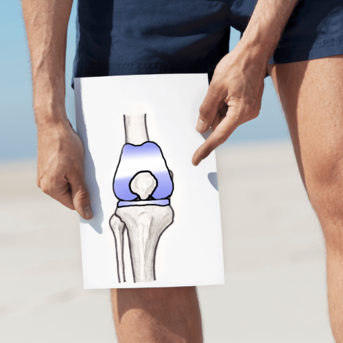 What are the best shoes to wear after a knee replacement?