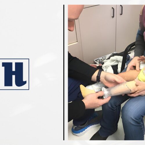 What Types of Pediatric Prosthetics are Transforming Young Lives? cover