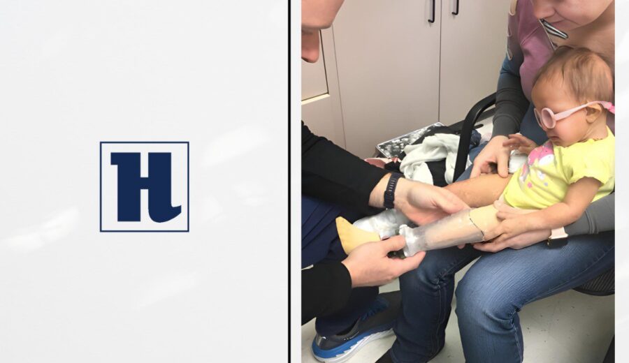 What Types of Pediatric Prosthetics are Transforming Young Lives? cover