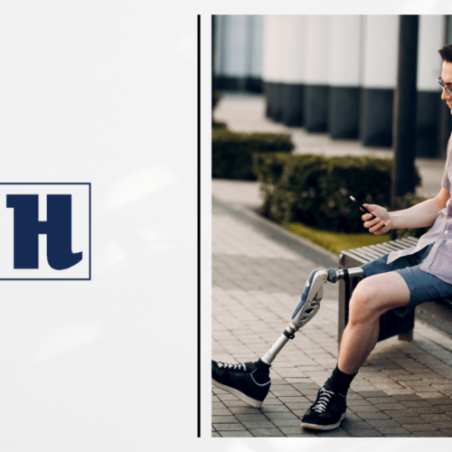 Are Custom Prosthetics for Legs Worth Considering? cover