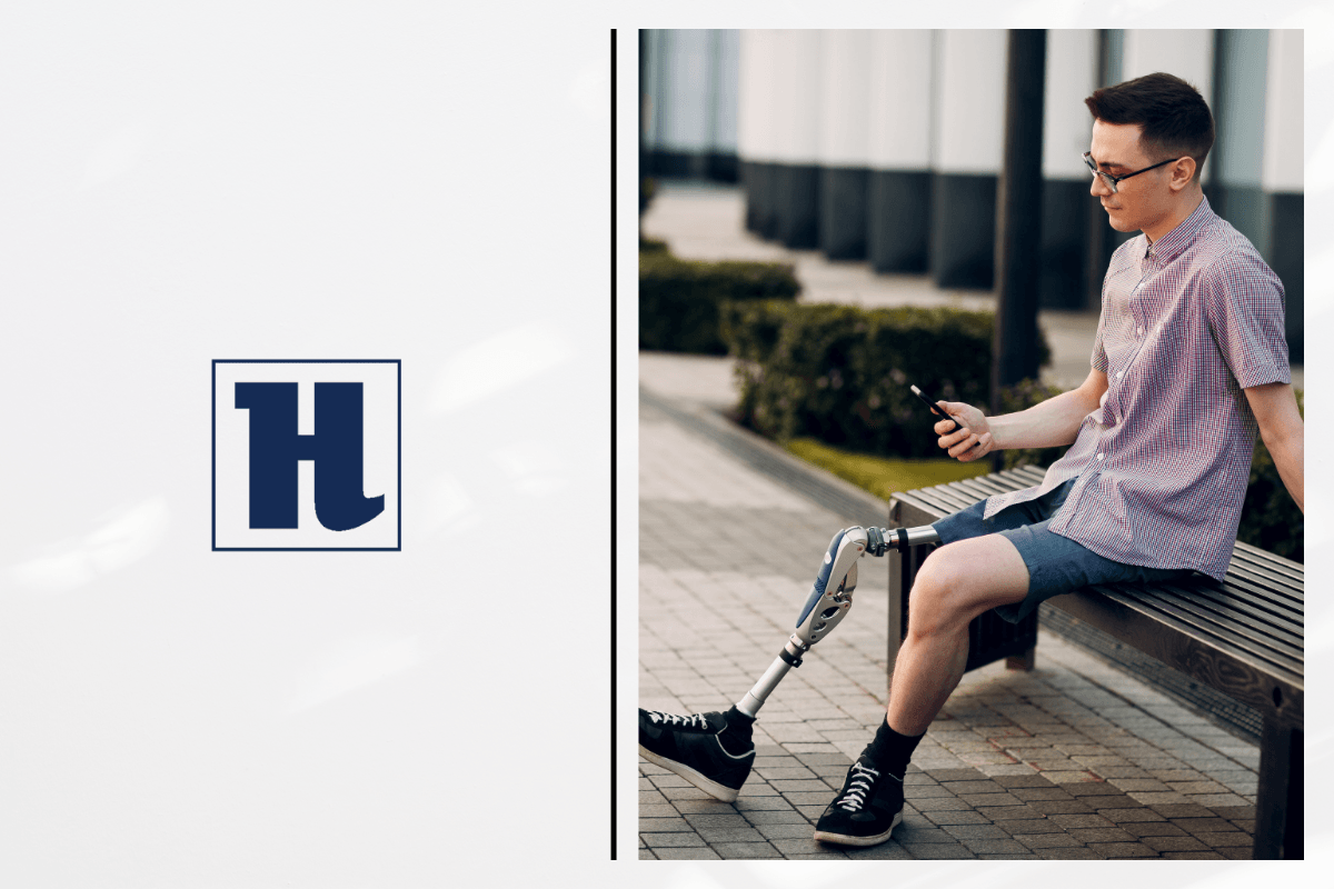 Are Custom Prosthetics for Legs Worth Considering? cover