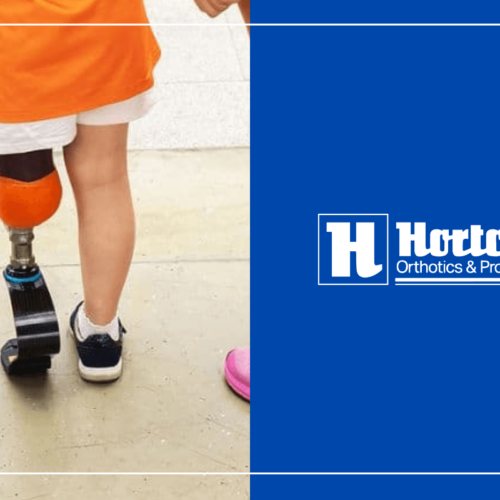 What Are Pediatric Prosthetics? A Comprehensive Guide cover