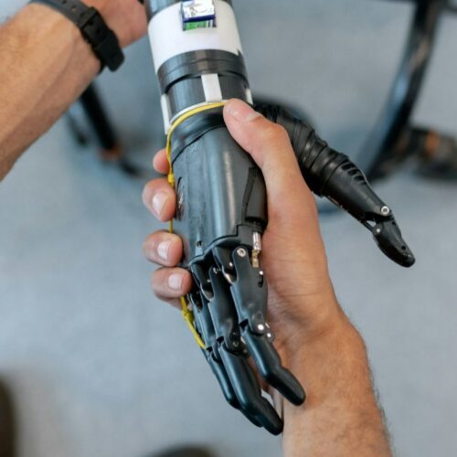 What Are the Main Types of Prosthetics? cover