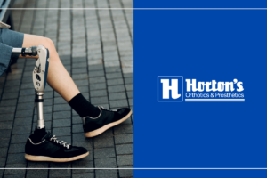 Advancements in Child Prosthetics Technology: A Brighter Future for Kids cover