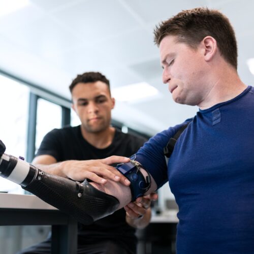 Can Custom Prosthetics for Arms Change Daily Routines? cover