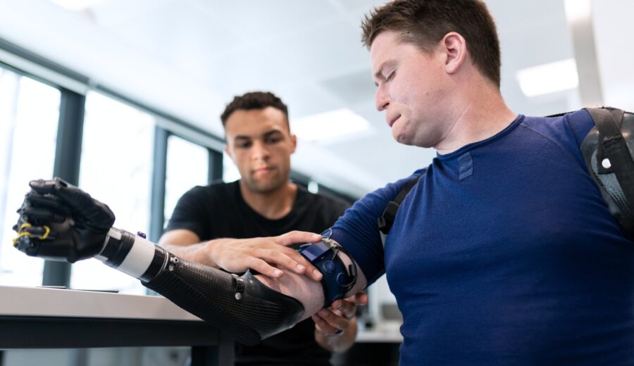 Can Custom Prosthetics for Arms Change Daily Routines? cover