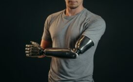 Man wearing a carbon fiber prosthetic arm, showcasing the lightweight and durable design that enhances mobility and performance.