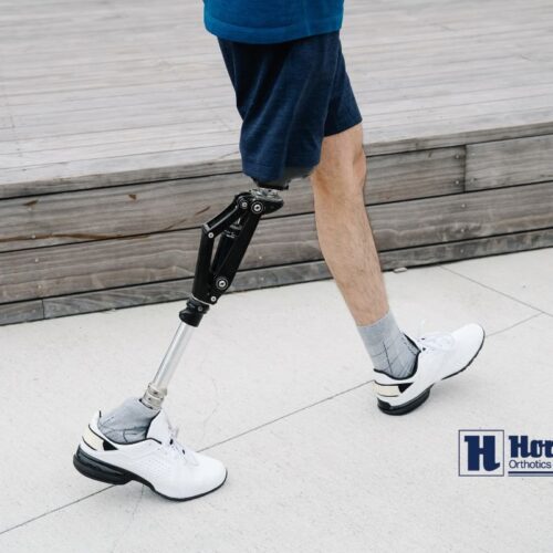 Prosthetic Feet: Which Type is Right for You? cover