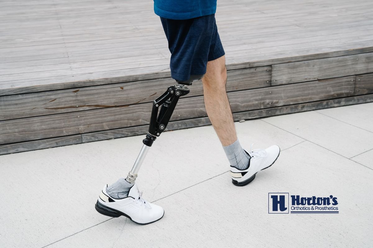 Prosthetic Feet: Which Type is Right for You? cover