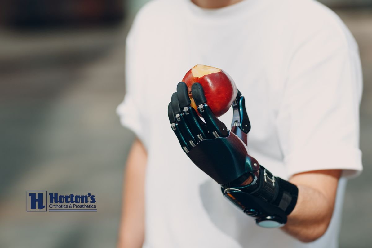Upper Limb Prostheses: What Are the Main Types? cover
