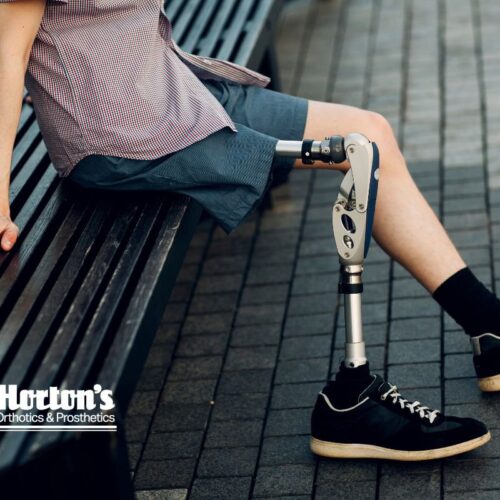 Lower Limb Prostheses: What Are the Types Available? cover