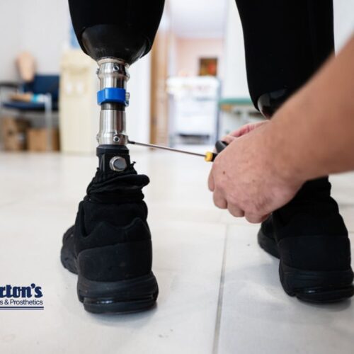 Prosthesis Fitting: What Should You Expect? cover