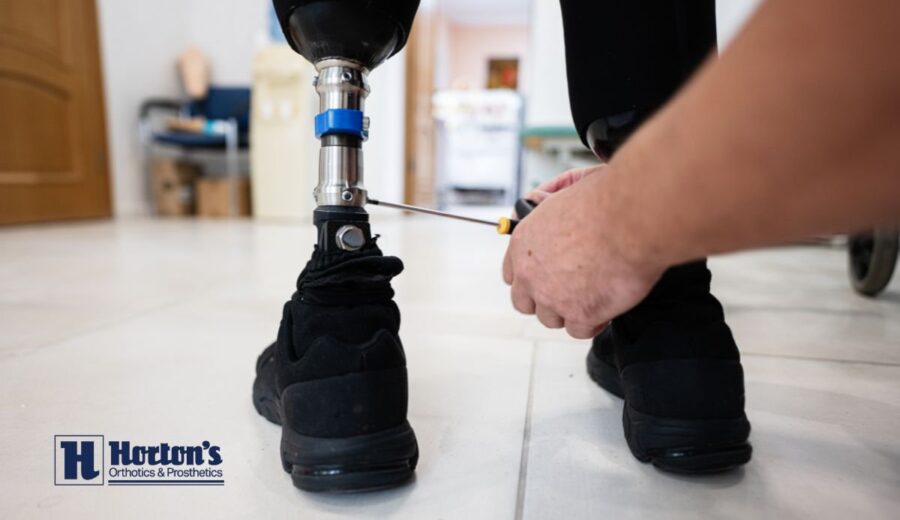 Prosthesis Fitting: What Should You Expect? cover
