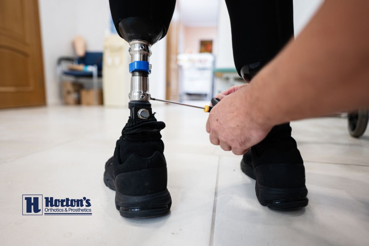 Prosthesis Fitting: What Should You Expect? cover