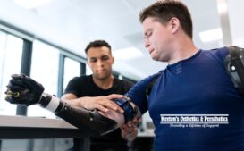Prosthesis Fitting Process: What Should You Expect First? cover