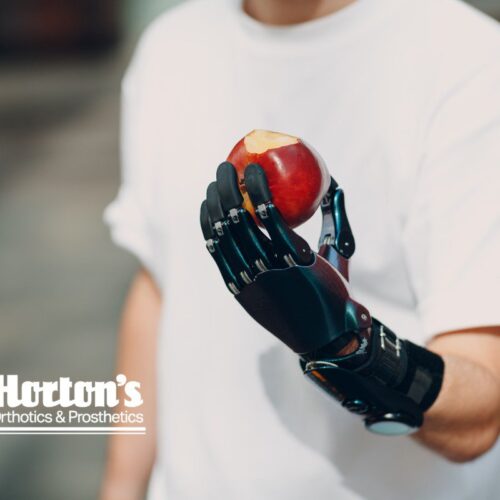 where to buy prosthetics