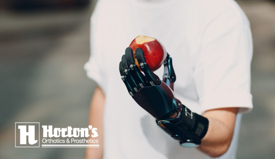 where to buy prosthetics