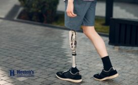 life after diabetes amputation