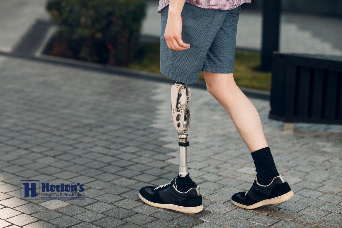 life after diabetes amputation