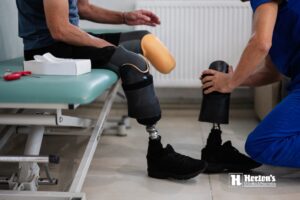 prosthetic fitting process