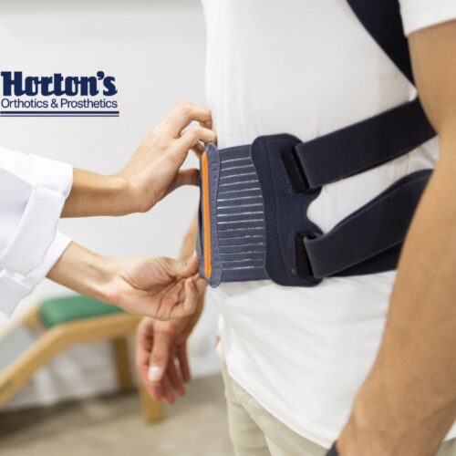 daily life with scoliosis brace